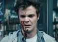 Hughie Campbell zou The Boys: Seizoen 5 toch kunnen overleven